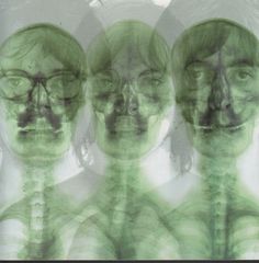 Thumbnail - SUPERGRASS